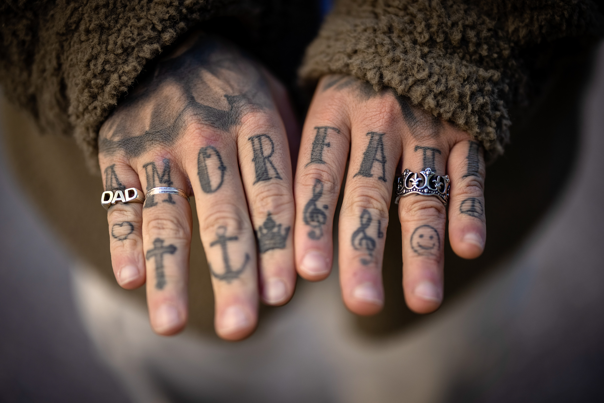 To foto etter hverandre, der det første er et nærbilde av mann med bleket hår og mørkt skjegg og øyne. Han holder en tatovert hånd opp mot venstre side av pannen. Det neste bildet viser begge de tatoverte hendene.