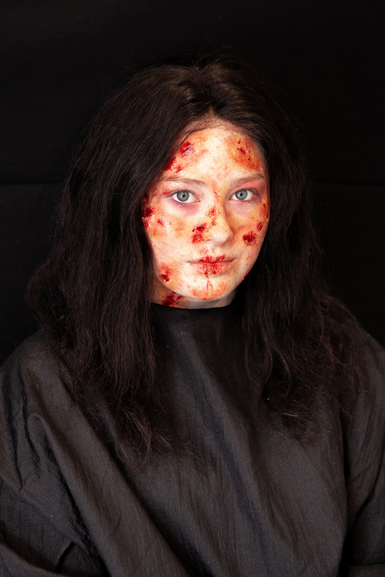 An example of character makeup: a student has fake casualty makeup on their face showing burns