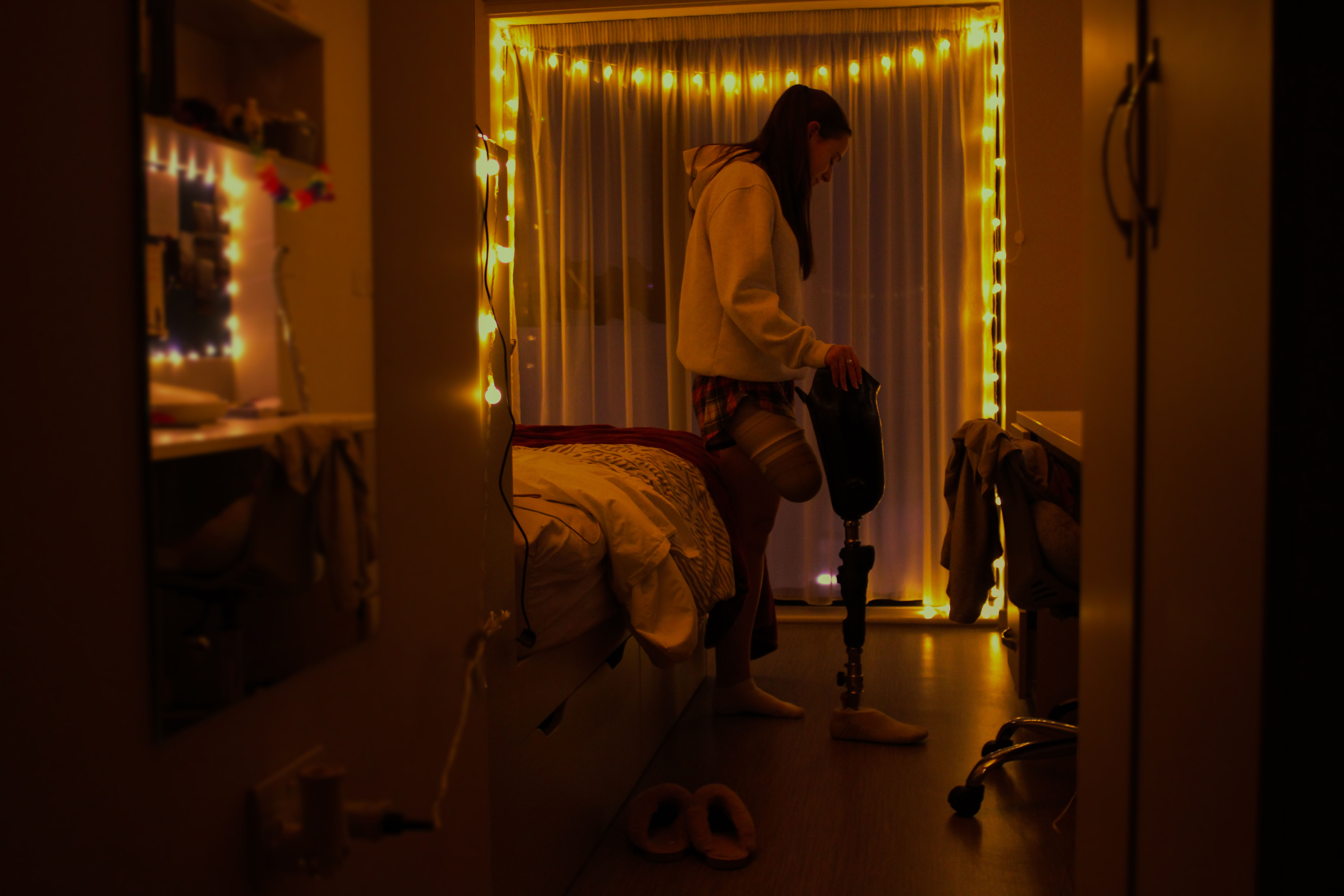 Person stood in a dim orange-lit room with fairy lights around window and curtain. They are stood with one hand balancing on their prosthetic leg, bed behind them.