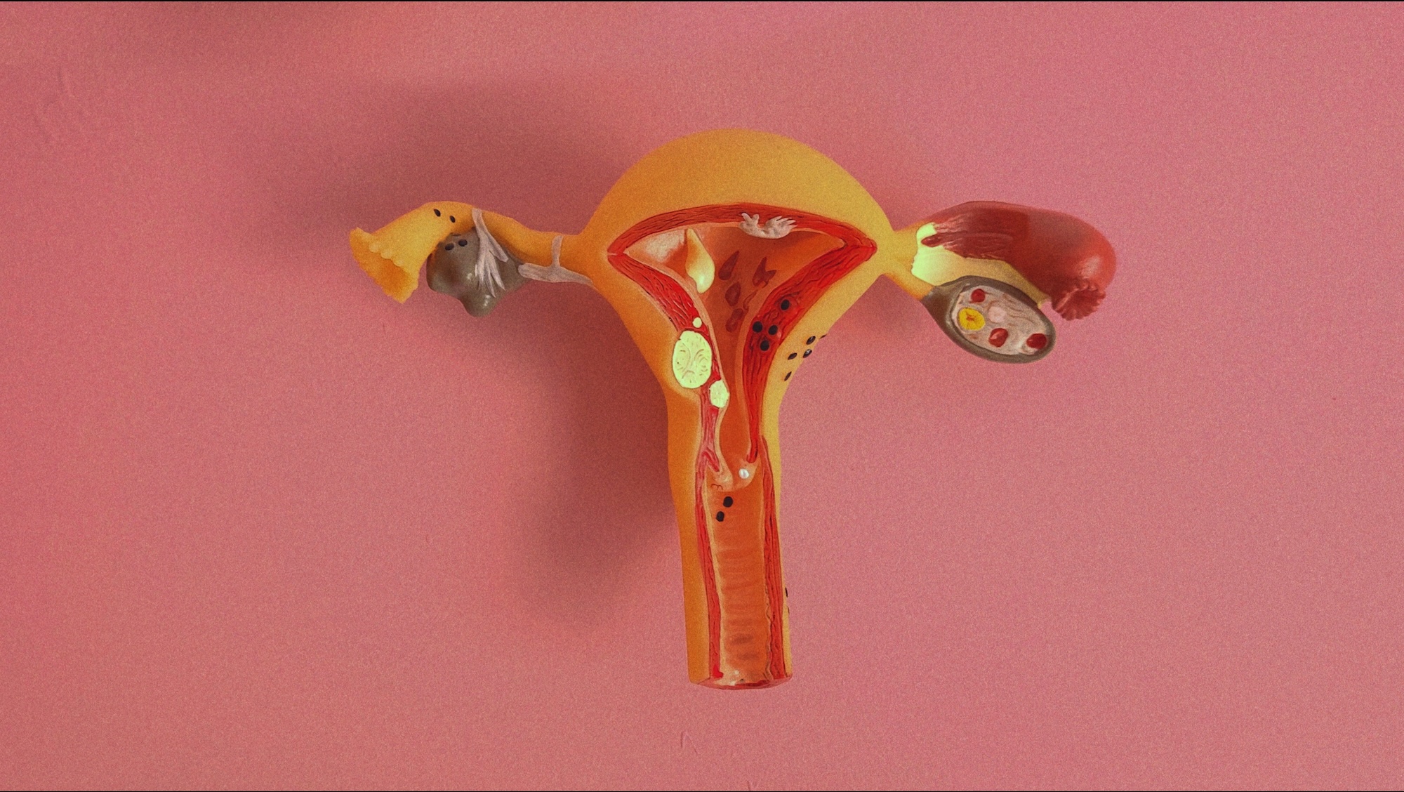 An anatomical model of the female reproductive system on a pink background, with the uterus and fallopian tubes shown in cross-section.