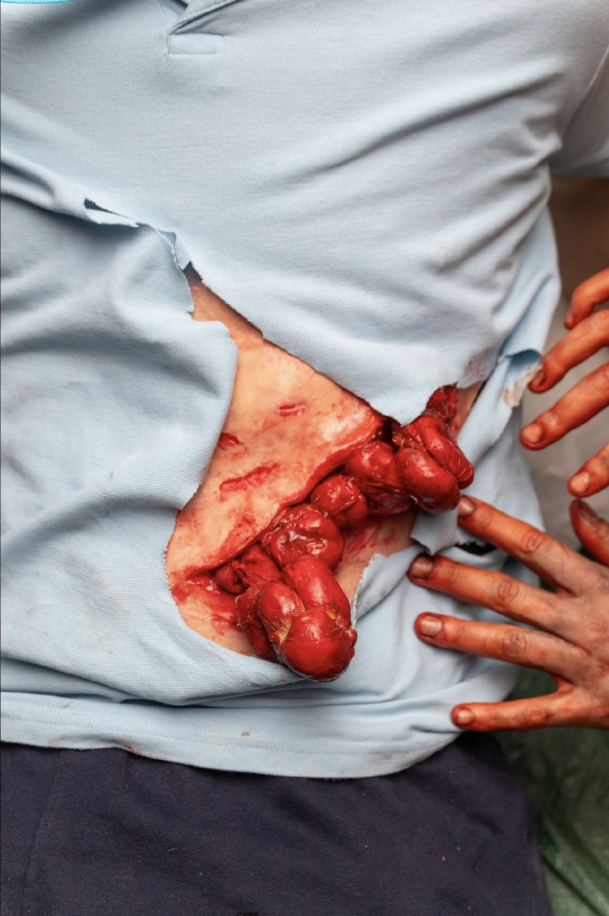 Prosthetic gore of a stomach injury through a ripped blue shirt.