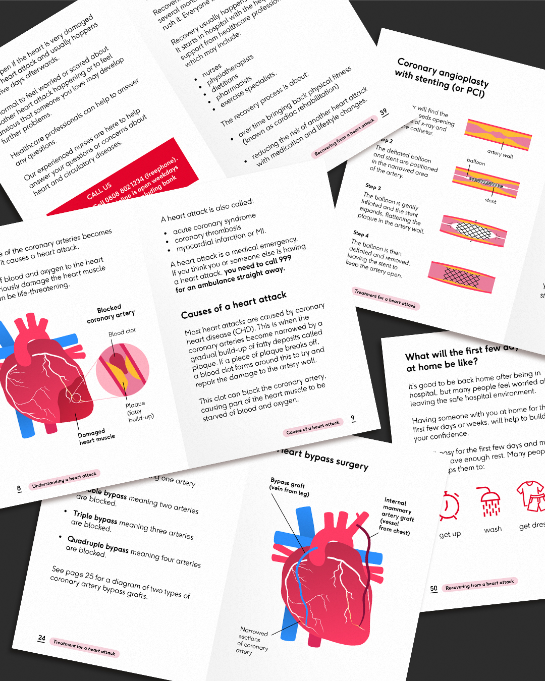 Several printed pages about coronary artery disease and angioplasty, arranged on a dark surface with the pages overlapping and tilted at different angles.