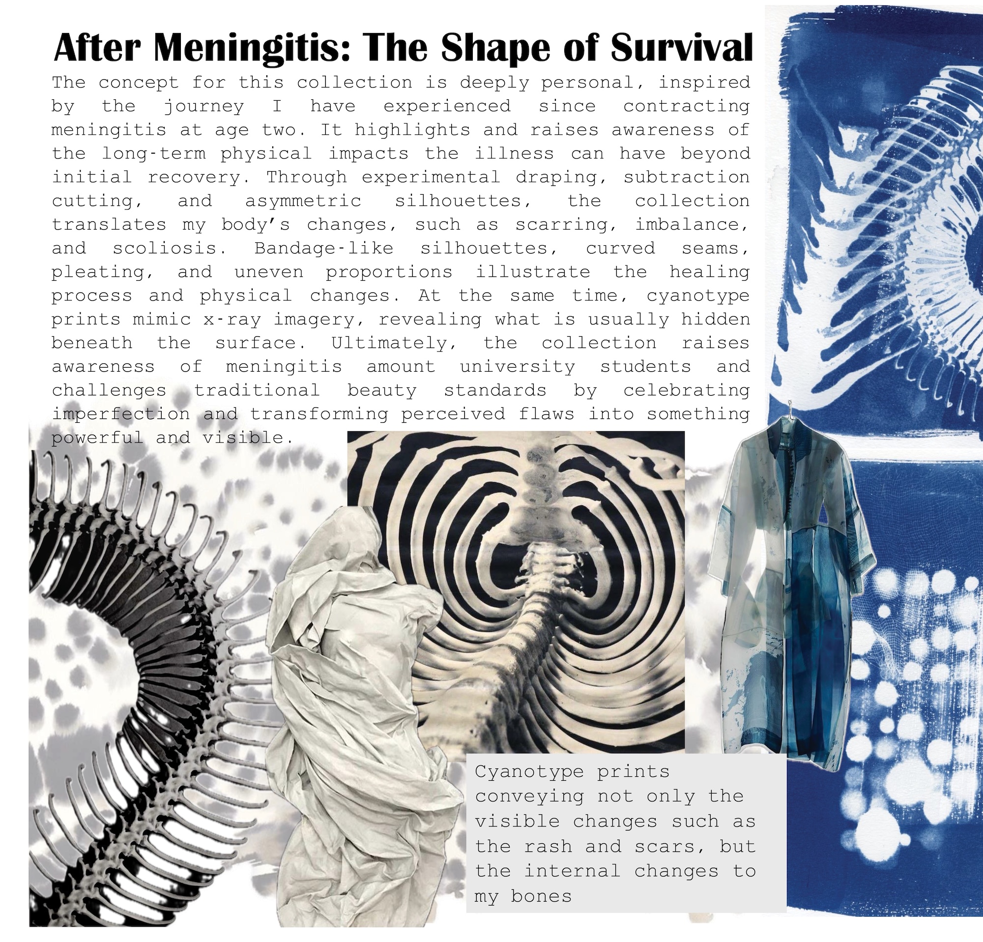 A collage poster titled “After Meningitis: The Shape of Survival” combines blue cyanotype prints, zebra-like ribcage patterns and layered fabric forms, with a text block at the bottom.