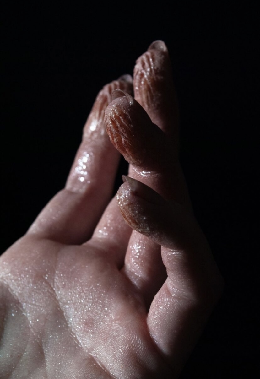 Close-up of a person's hand, showing several deep cuts on the fingertips.