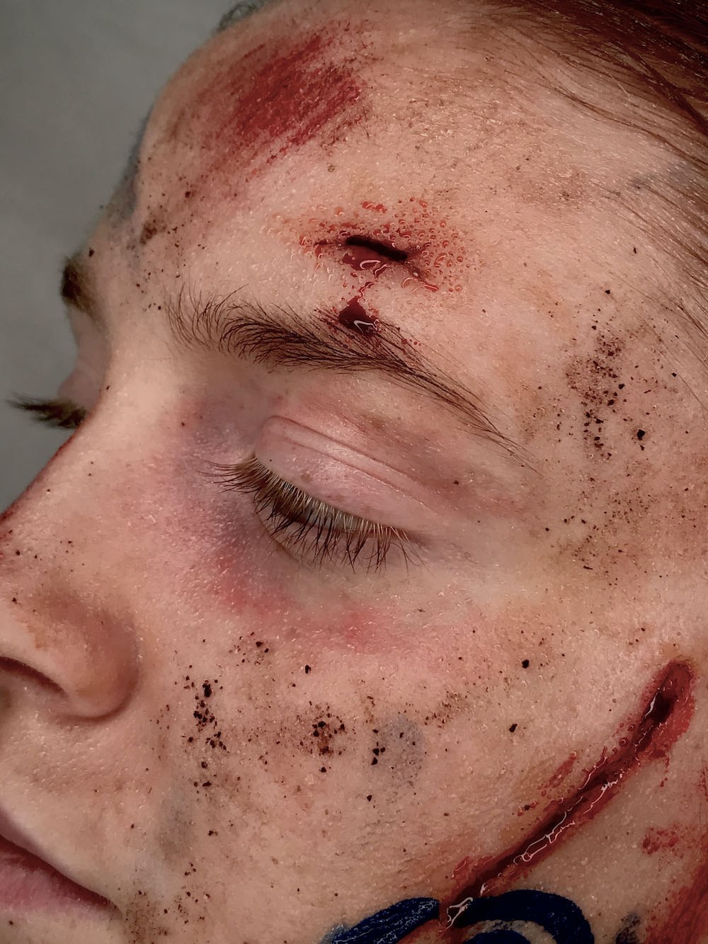 Close-up of a man's face with makeup showing bruising, cuts and scrapes on their skin.