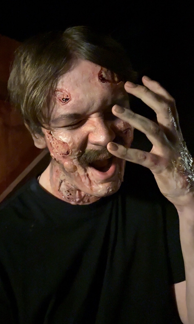 A man with disfigured skin and wounds on his face raises his hand to his face, appearing to express distress. He is wearing a black t-shirt, and the background is dimly lit, suggesting a dramatic setting.