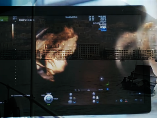 A dark tablet screen showing a medical scan with a side-profile face image and technical data, reflected against a bright window.
