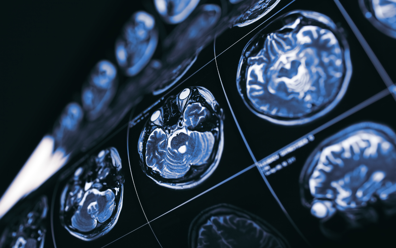 Investigating brain injuries