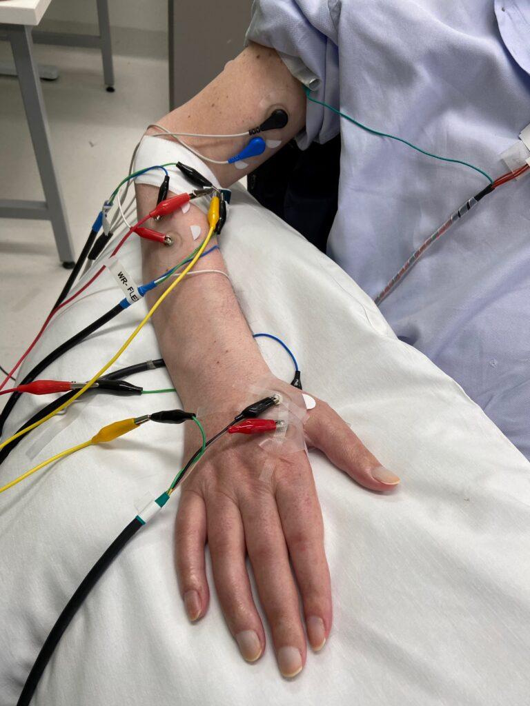 Neurostimulation 768x1024