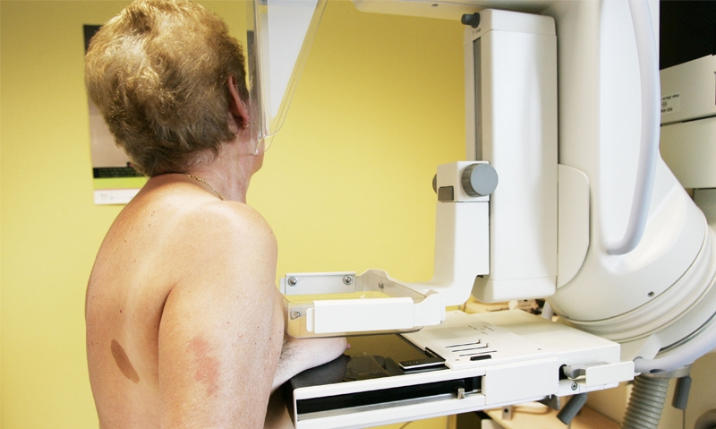 Breast screening