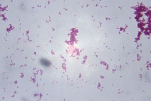 Gonorrhoeae large