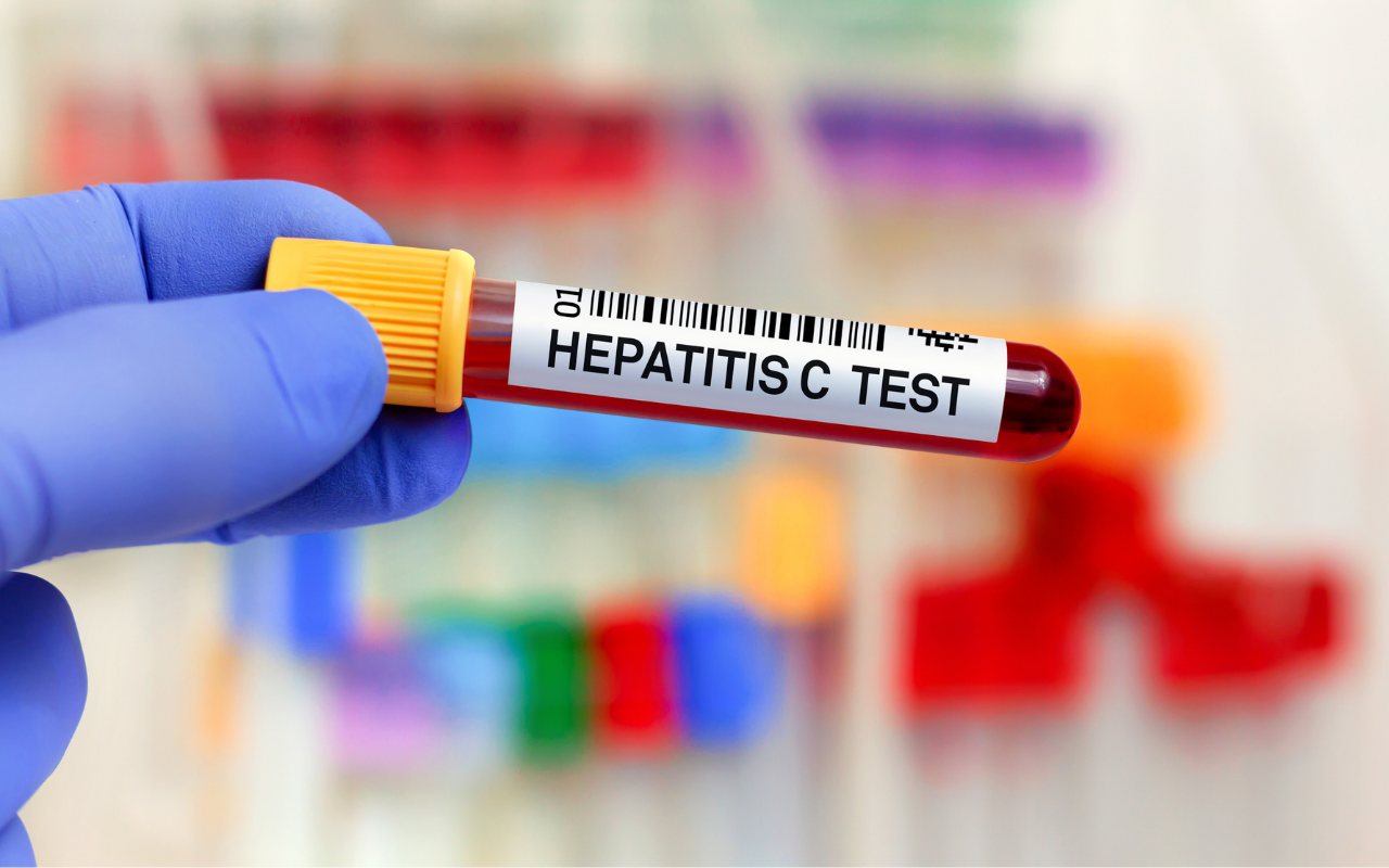 Tackling treatment hesitancy in people with hepatitis C - Featured Image