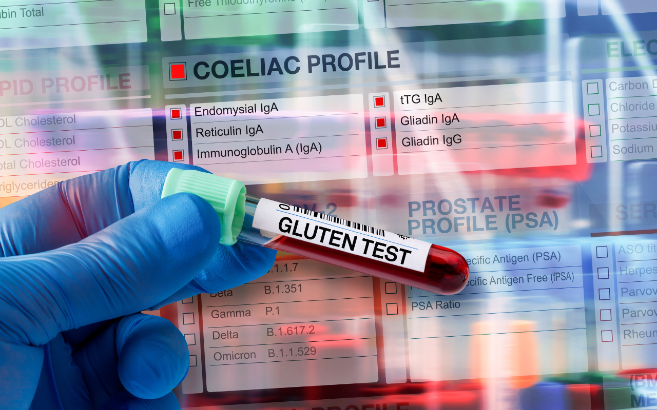 Family of people with coeliac disease urged to get tested  - Featured Image