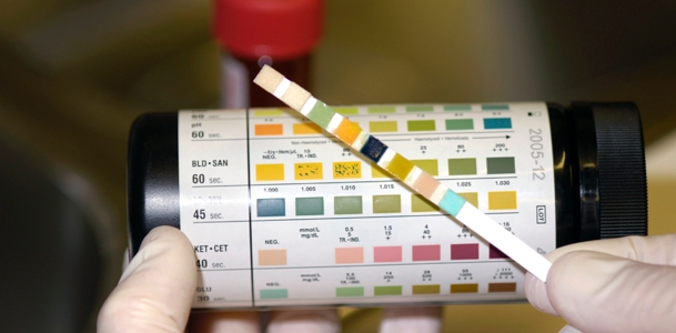 Urine sample large