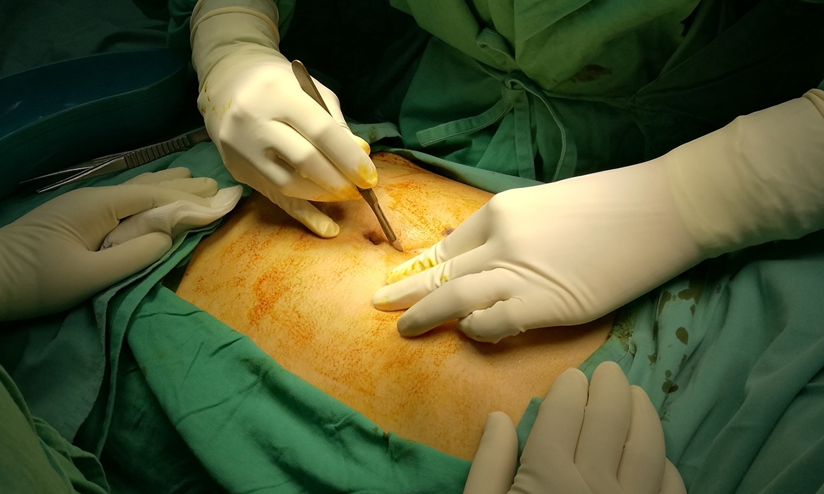 Acute abdomen: fast-track pathway will save lives, and millions - Featured Image