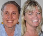 Ann Gregory - Featured Image