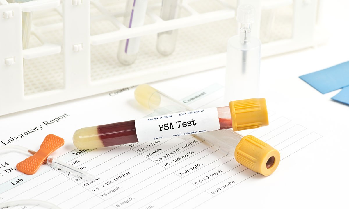 Are low risk prostate cancer patients properly monitored 708