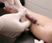 Simple diabetes screening test will work - Featured Image