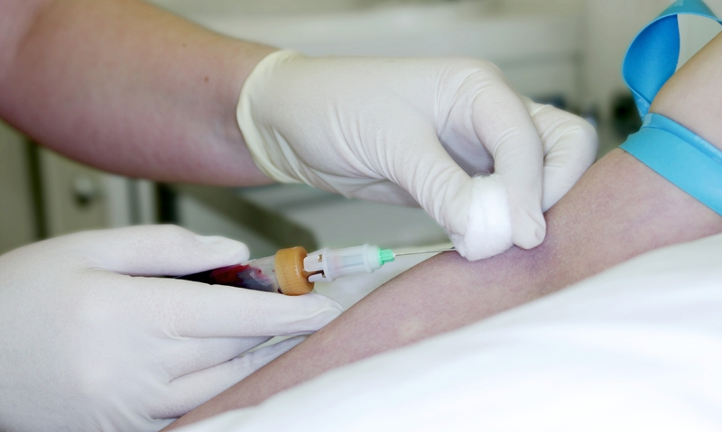 Troponin assays improve diagnosis - Featured Image