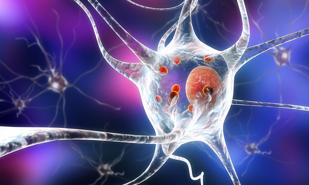 Broadening our view of Parkinson disease - Featured Image