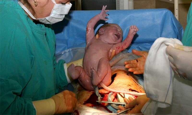 Newborn retrievals “avoidable” - Featured Image