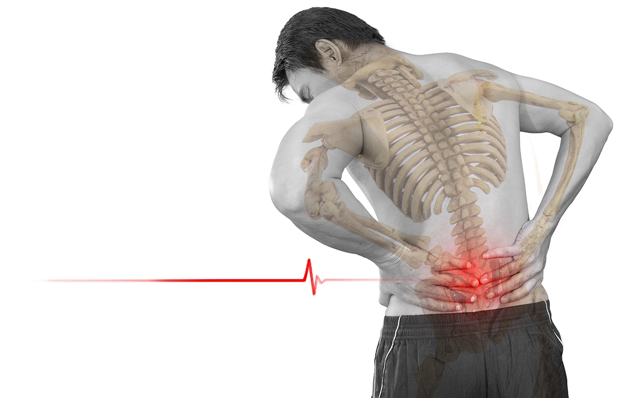 Cannabidiol for acute low back pain can be put to bed 199