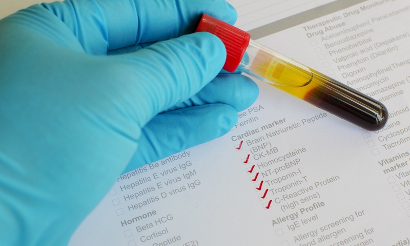 Troponin test concerns - Featured Image