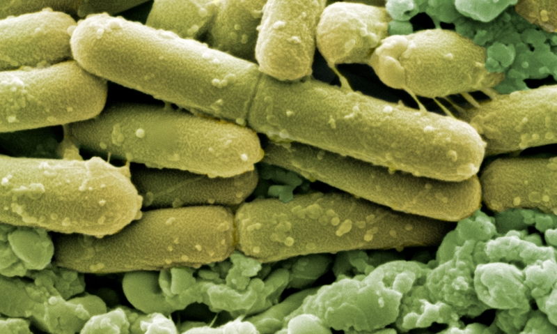 C. difficile vigilance essential - Featured Image