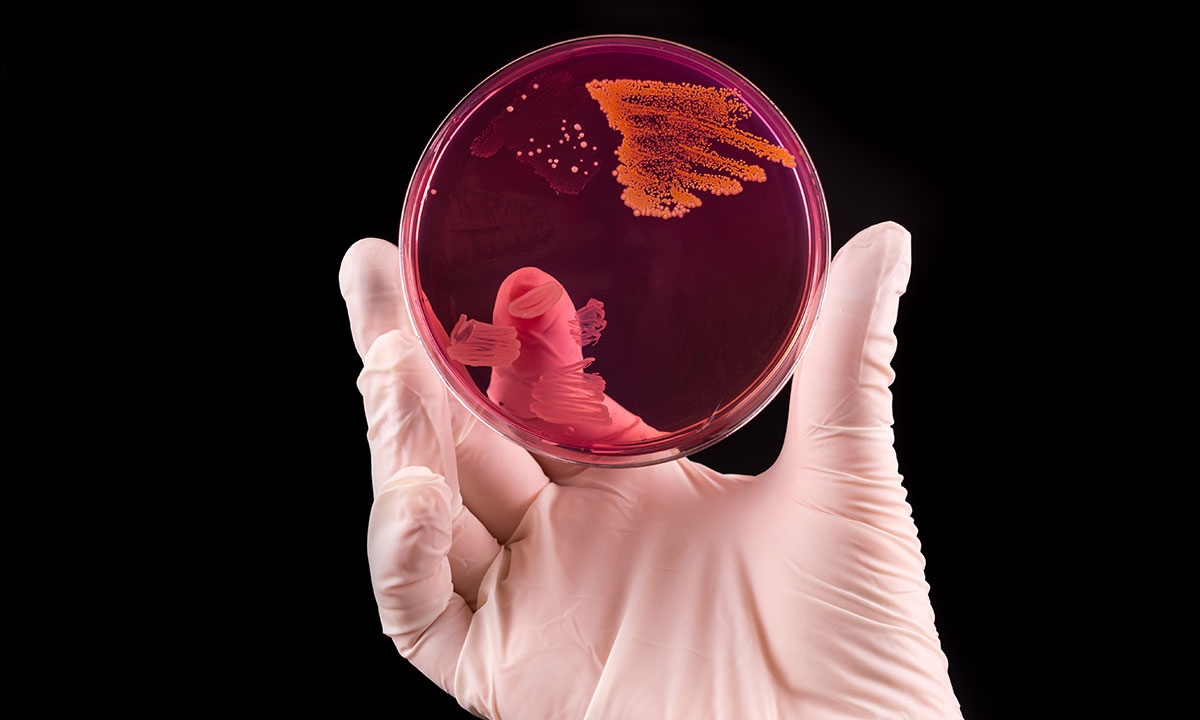 Community golden staph on the rise but there is good news 151