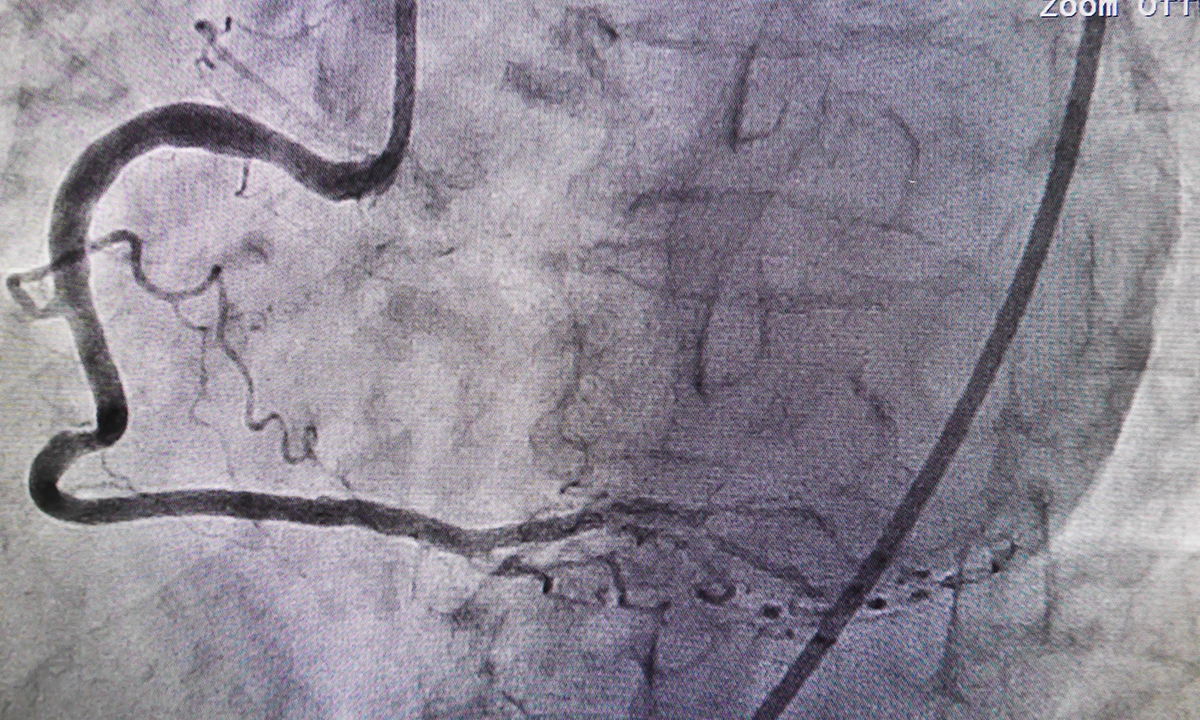 Disparities in cardiac care must end - Featured Image