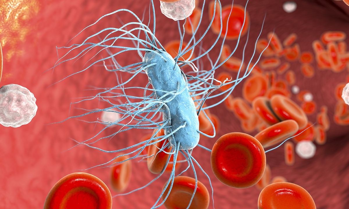 Counting sepsis cases accurately - Featured Image