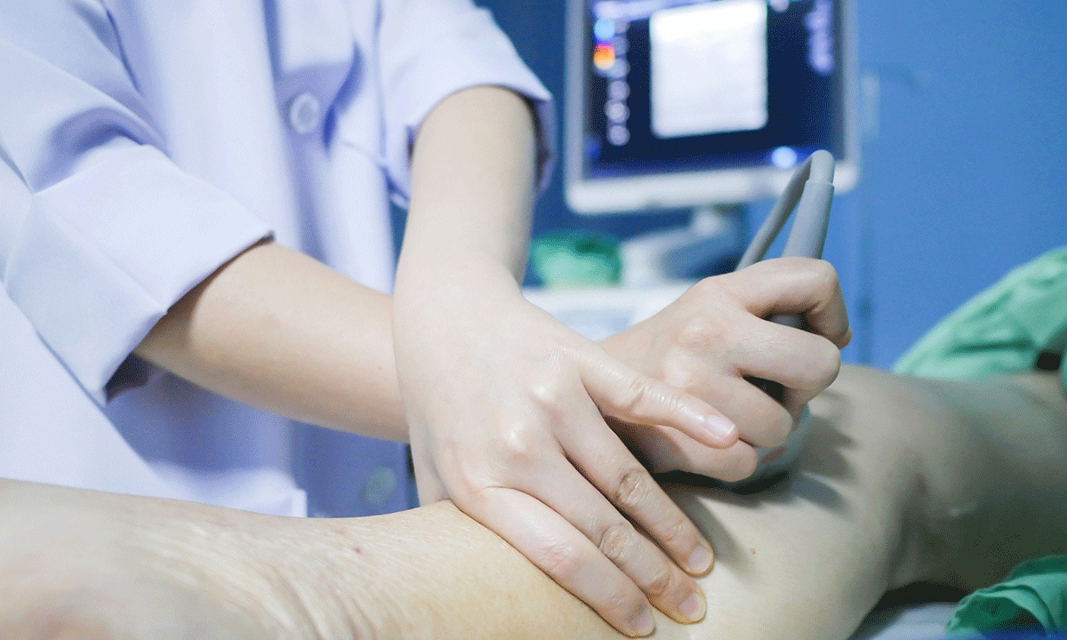 Deep vein thrombosis maintain the suspicion 423