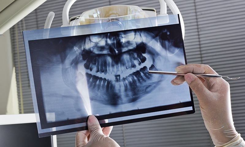 Rural dentistry model needs change - Featured Image