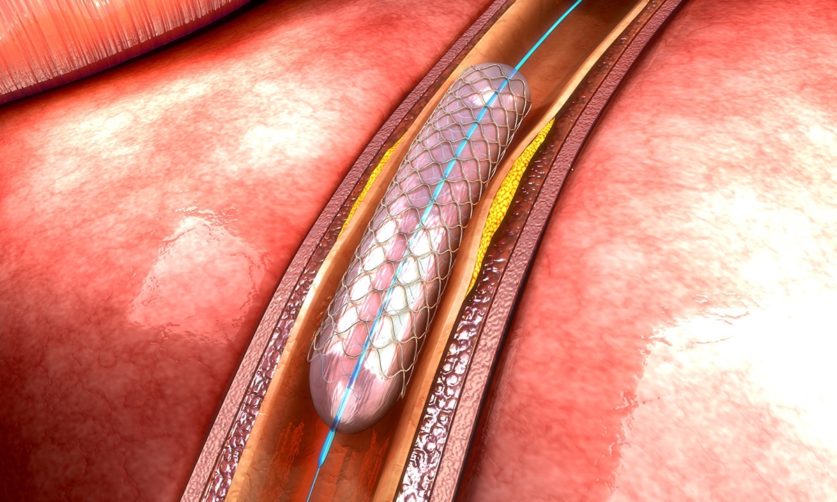 Disparities in cardiac care must end - Featured Image