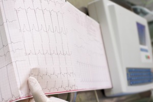 Ecg large