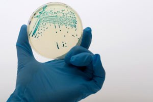 Ecoli large