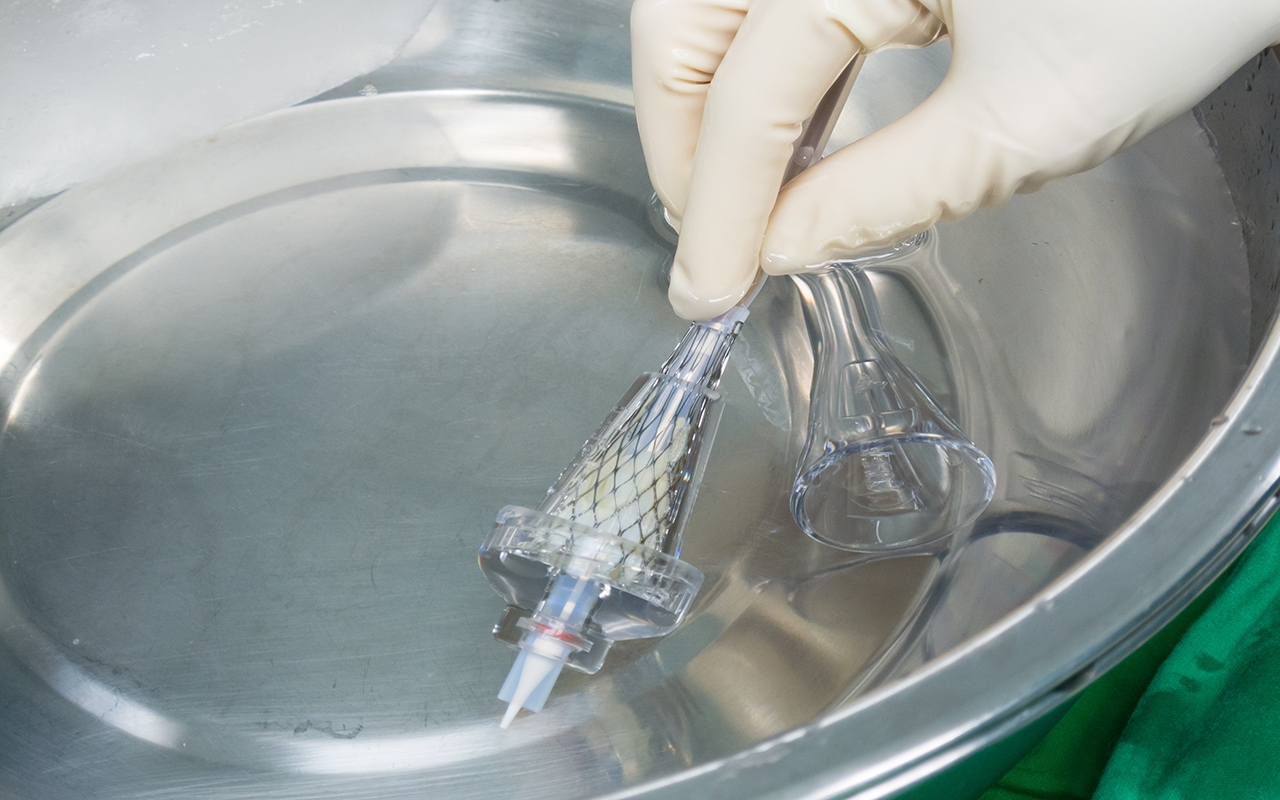Expanding cohort benefitting from tavi for aortic stenosis 994