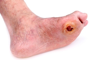 Foot large