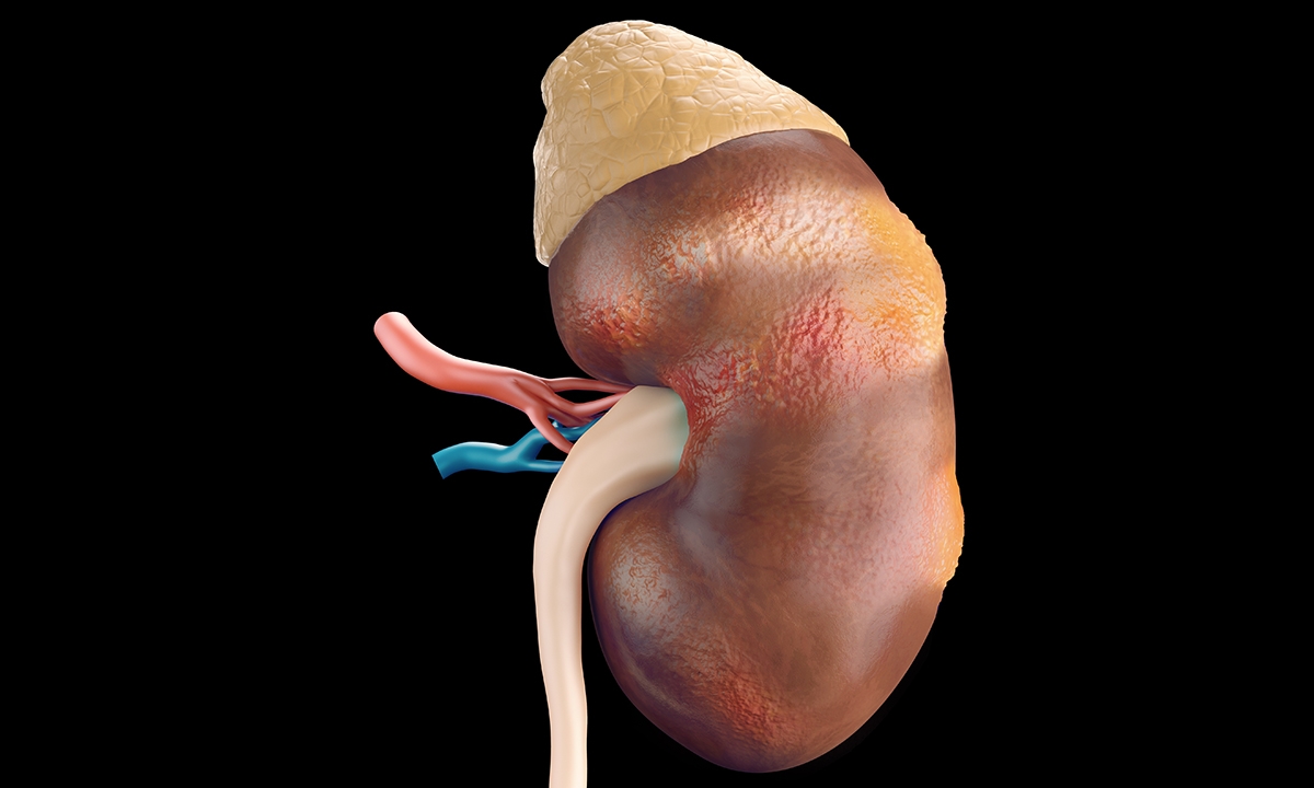 GP follow-up all important for renal mass - Featured Image