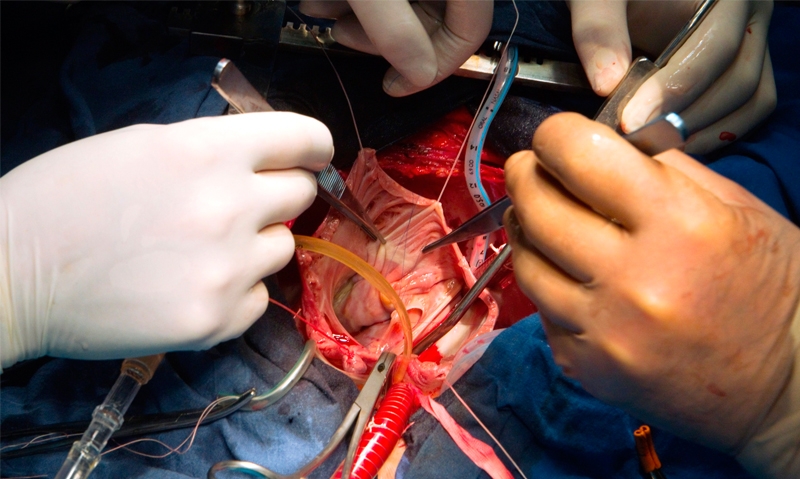 Tick for subspecialisation - Featured Image