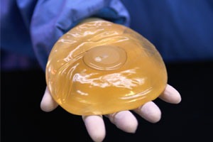 Implant large1