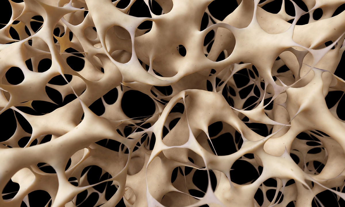 Integrated care for osteoporosis - Featured Image