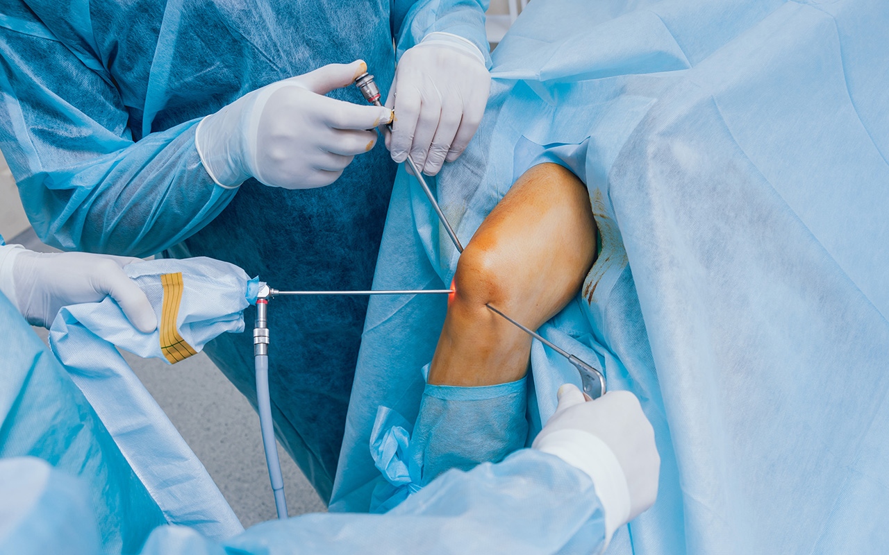 Knee arthroscopy: changing practice - Featured Image