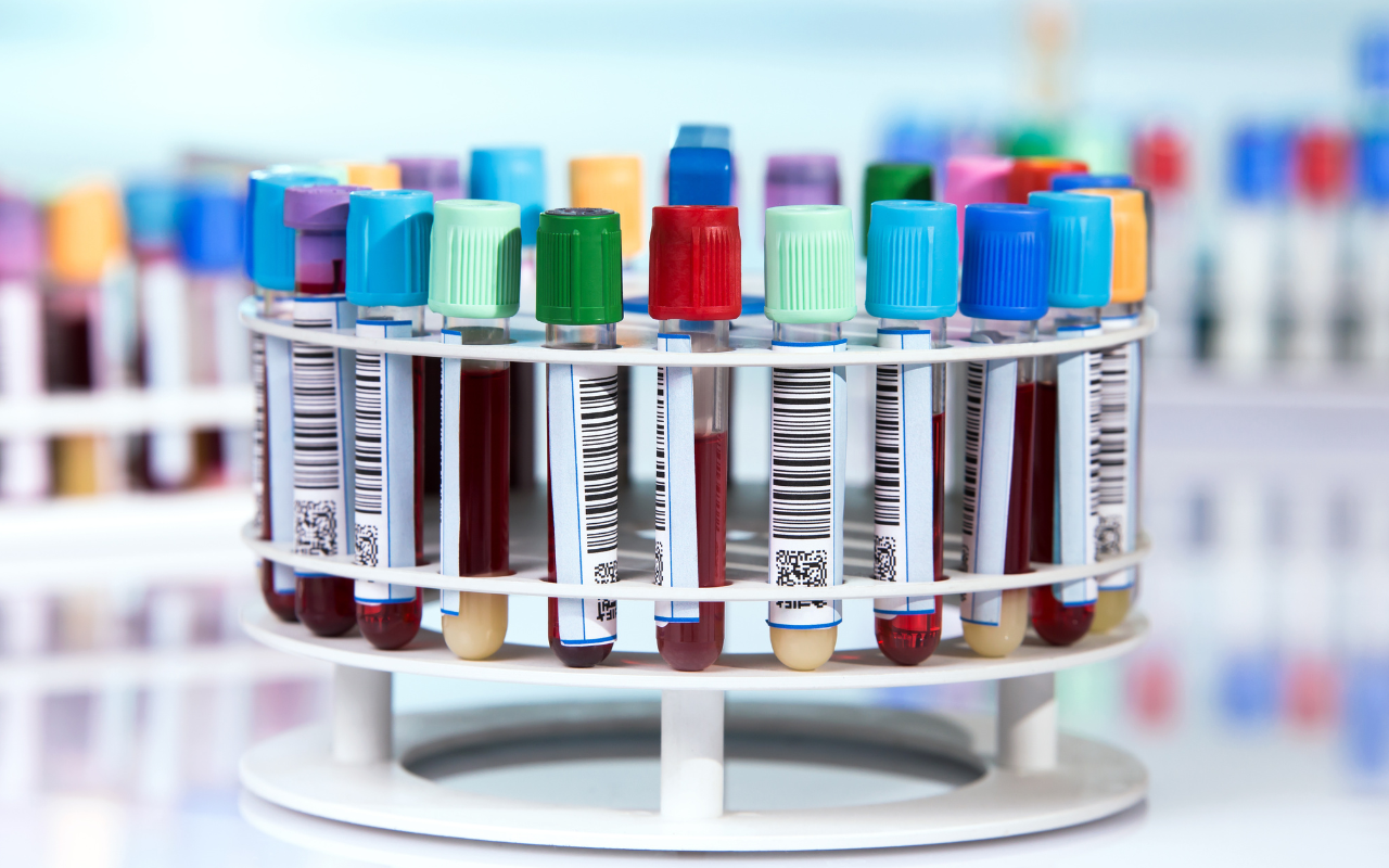 Concerns the pathology bulk-billing campaign is about 'driving industry profits' - Featured Image