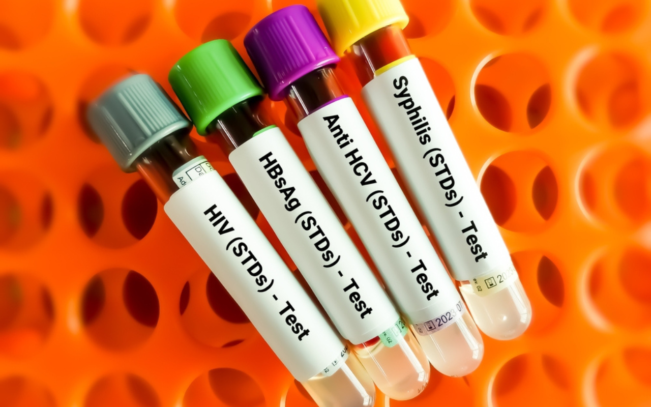 Infectious syphilis and other STIs on the rise - Featured Image