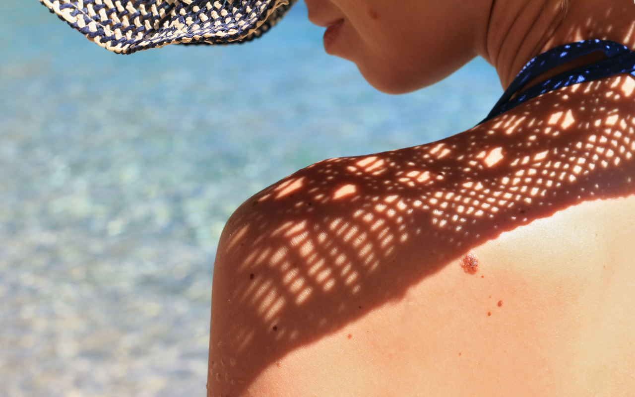 Towards evidence-based skin checks - Featured Image