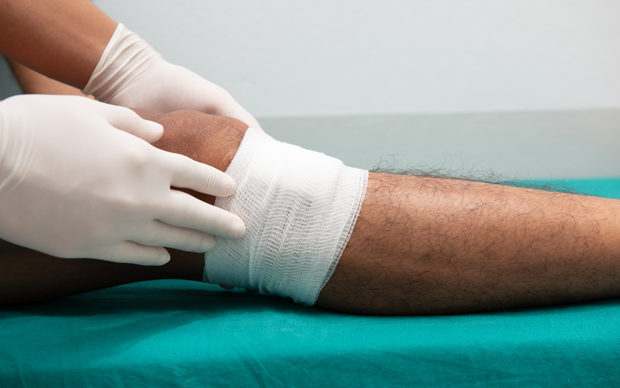 Consensus statement for managing Buruli ulcer infections - Featured Image