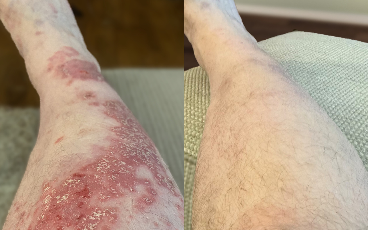 Lead image 2025 06 13 T140132 401