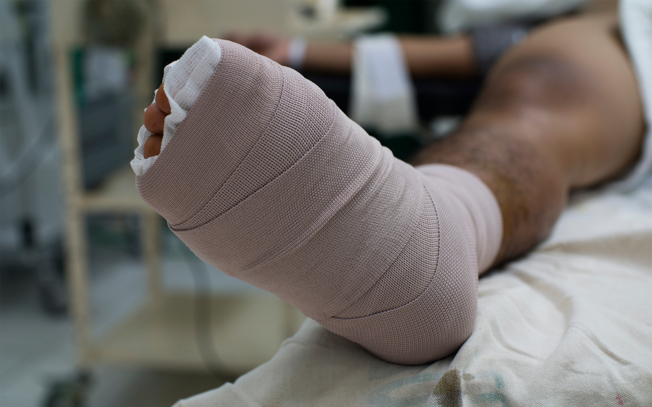 Reducing hospitalisations for diabetic foot ulcers - Featured Image