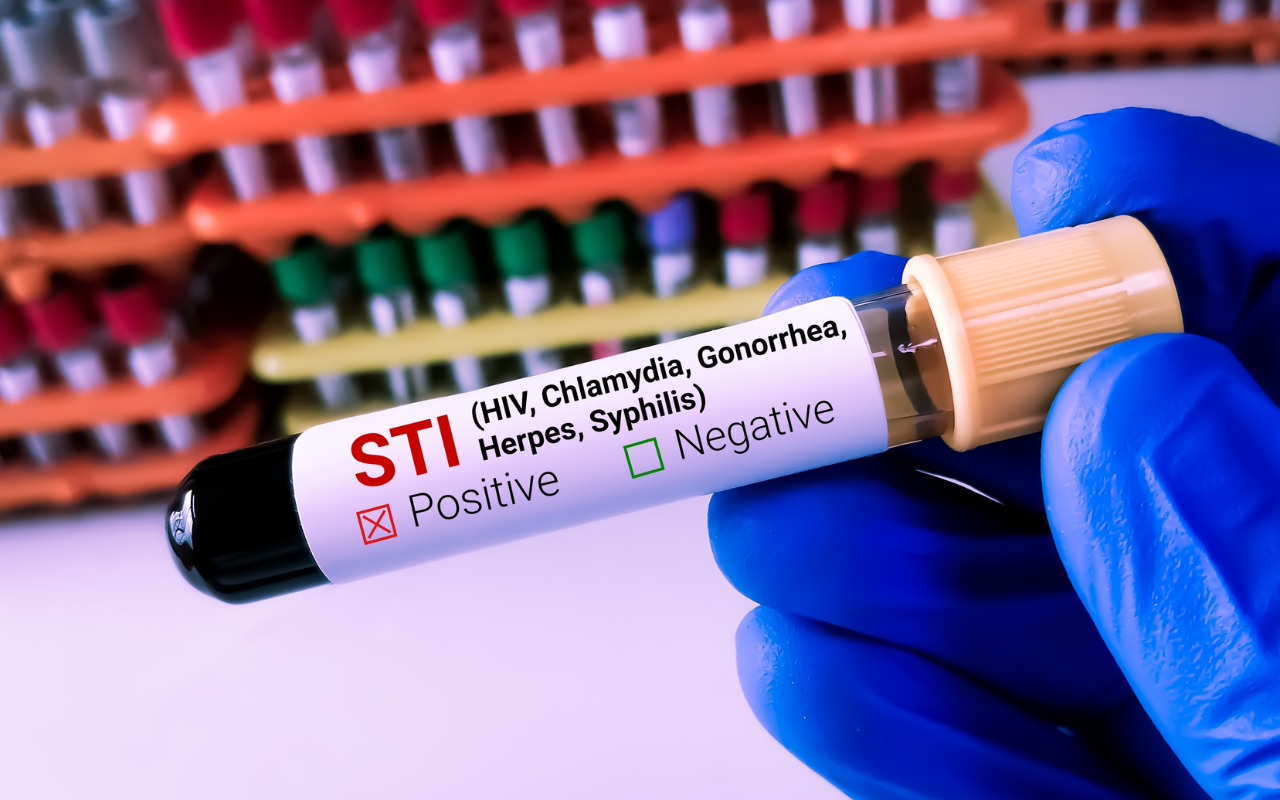 Consensus statement on use of doxy-PEP - Featured Image